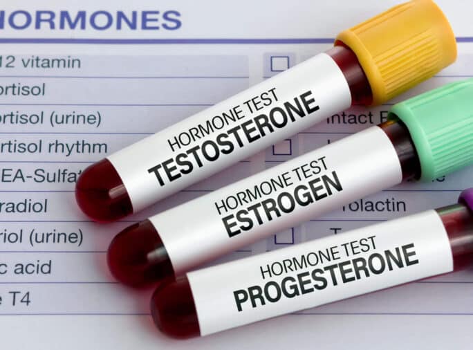 Hormone Wechseljahre