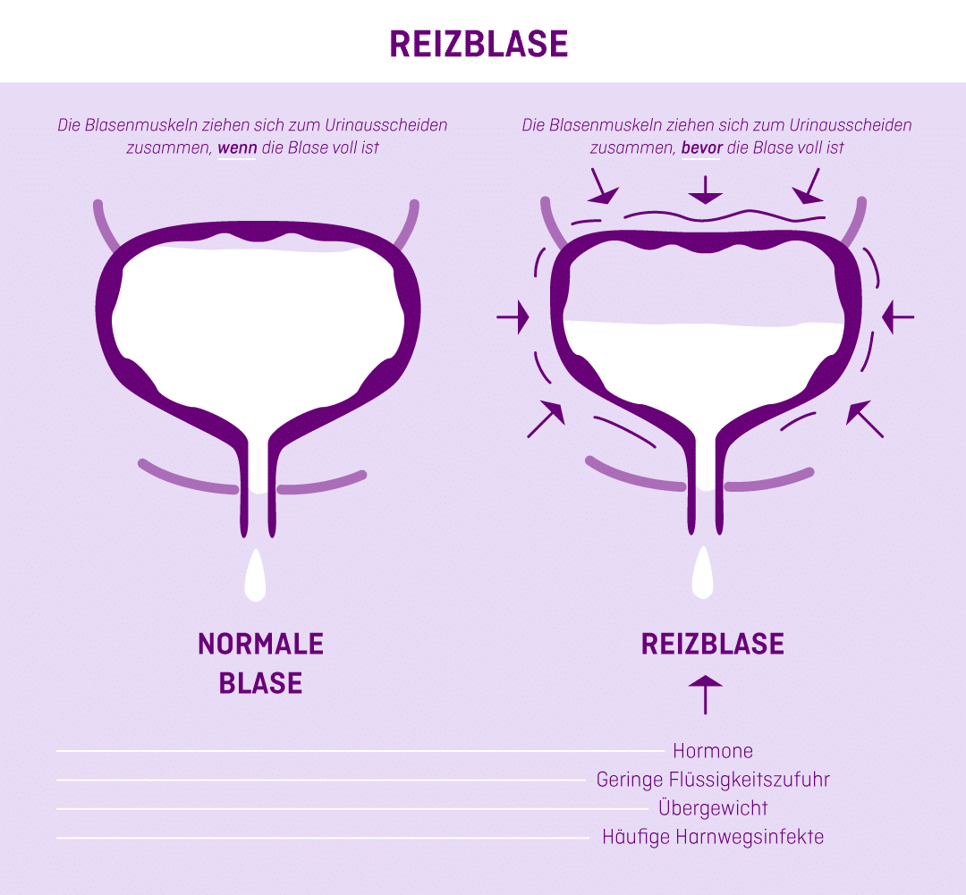 01-10-24-Graphics-reizblase